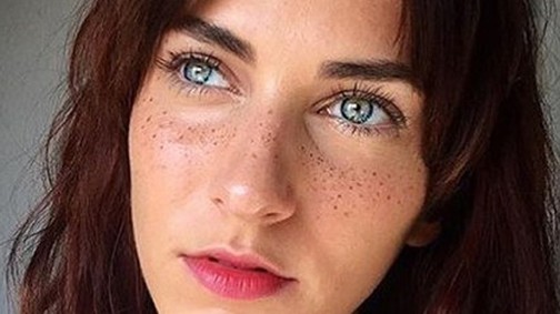 Új őrület! Szexi szeplőket szeretnél? Eljött a te időd!