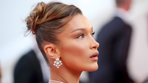 Kifejezetten undorító plasztikai műtét a sztárok hangsúlyos arccsontjának titka