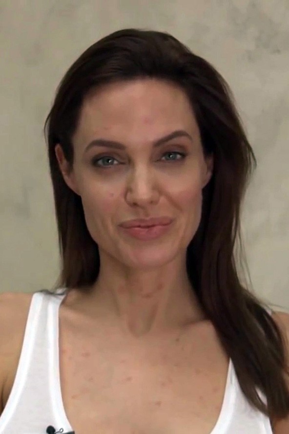 Így fest a himlős Angelina Jolie