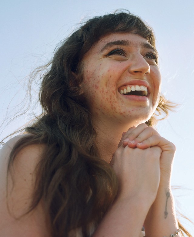 Harcban a bőröddel: 3 nő, különböző bőrproblémákkal - mit mond a szakértő?