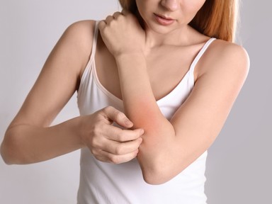 Atópiás a bőröd? Így ápold!