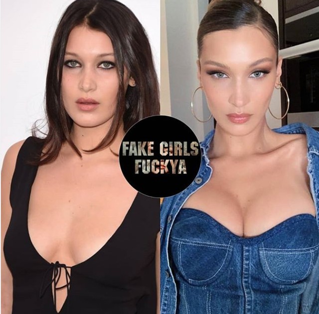 Ezek a fotók bizonyítják, hogy Bella Hadid arcát teljesen átszabták