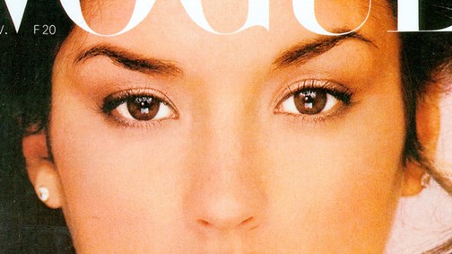 Kifizetetlen plasztikai beavatkozások - Anyagi csődben az első szupermodell