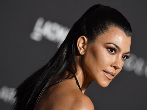 Sztárok, akik probléma nélkül felvállalják a striáikat