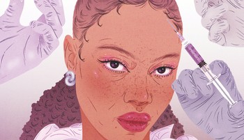 Hatékony és korszerű megoldás hajhullás ellen - ismerd meg a fejbőr injekciózás hatásait