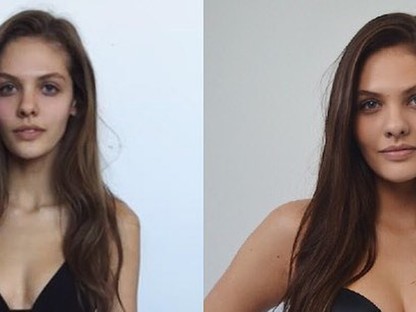 Elképesztő! 15 kg-ot hízott a modell alkatú lány és így vált igazi bombázóvá! 