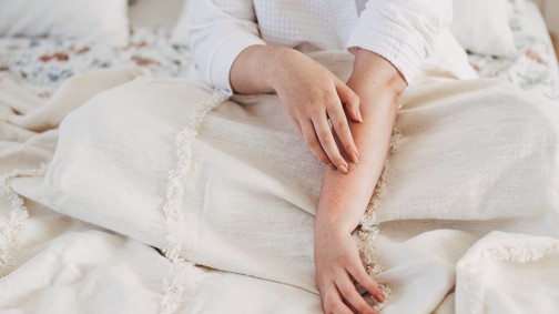 Kiderült, kiket szeretnek legjobban a szúnyogok: undorító oka lehet, ha pont téged választanak