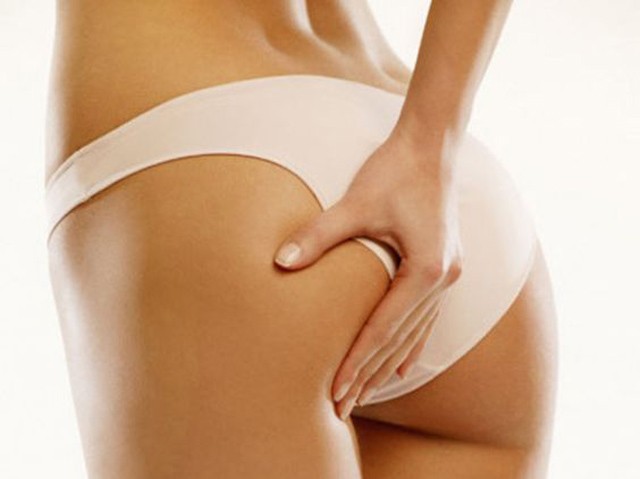 Feszes a tempó? Itt vannak a legjobb bőrfeszesítő termékek a narancsbőr ellen