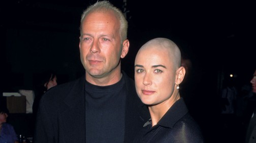 Ijesztő? Szexi? Ezek a nők kopaszra borotválták a fejüket