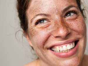 Léteznek csodaszerek, amelyekkel megszüntethetőek a ráncok?