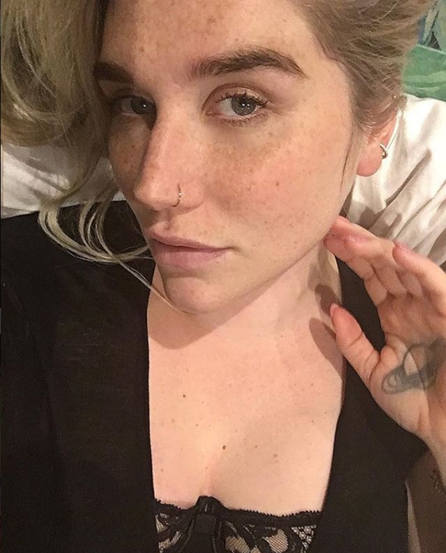 Kesha