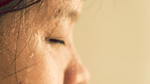 A túlzott izzadás rengeteg embert érint, de könnyen kezelhető!