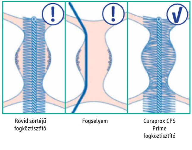 A csillogó, egészséges mosolyért