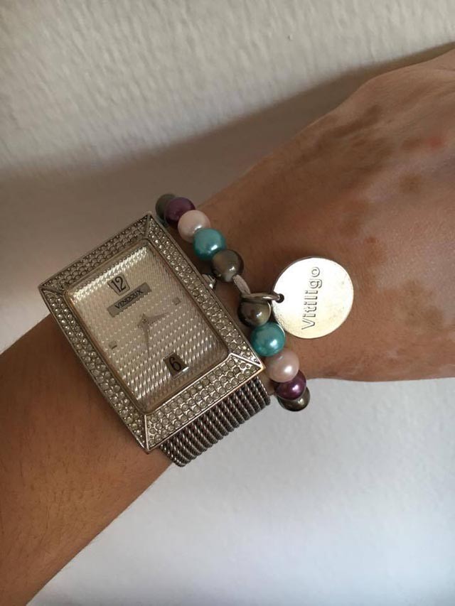 Széles Adrienn elegáns ruhában ma