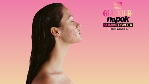 A pattanások hatékony ellenszereit is beszerezheted a GLAMOUR-napok Summer Week kuponjaival