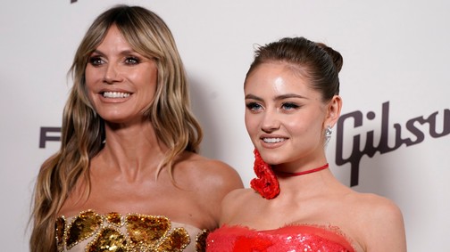 Igen, Heidi Klum lánya pattanásos, és nem fél megmutatni