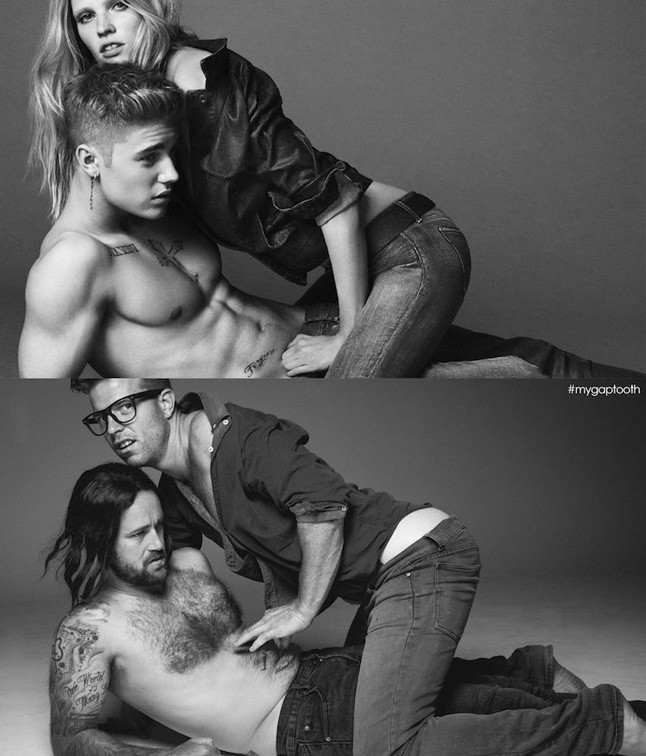 A fogam közötti rés