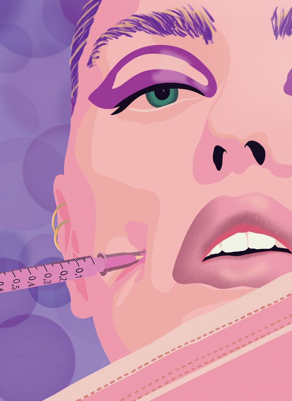 Filler-teória: tudj meg többet az esztétikai és plasztikai beavatkozásokról!