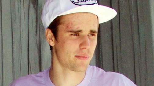 Egyre extrémebb: Justin Bieber fogékszert és új piercinget csináltatott