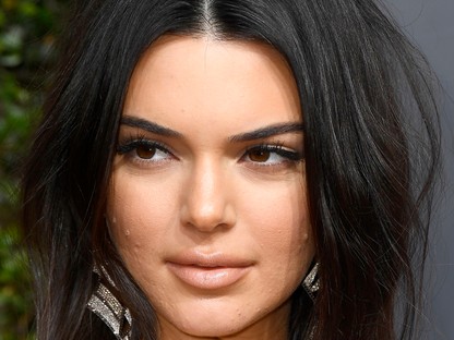 15 sztár, akiknek nagyon problémás a bőre, és mit tesznek ellene