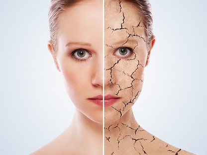 Száraz a bőröd? Meglepően sok oka lehet, íme mit kell tenned