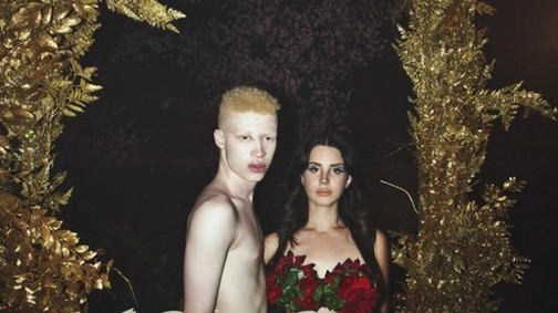 Shaun Ross egyáltalán nem mindennapi jelenség