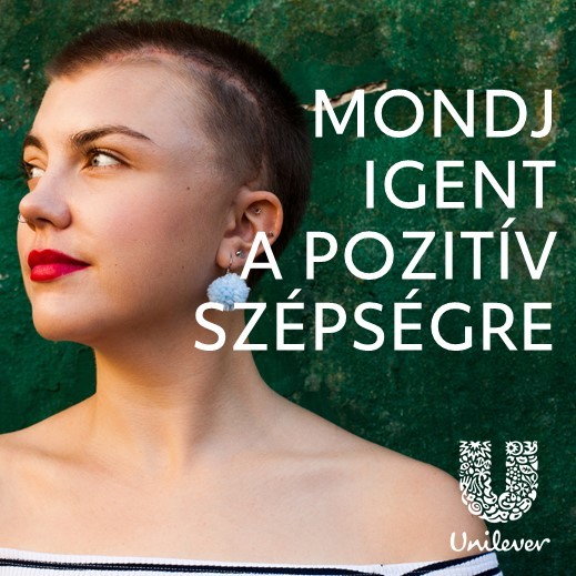 Ki mondja meg, hogy milyen a normális bőr, haj? Az Unilever például többé nem