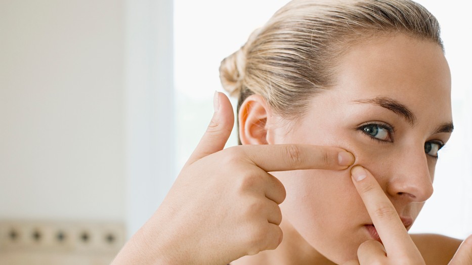 Hogyan szabadulj meg a mitesszerektől?