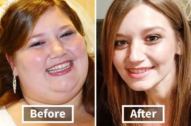 Így változik az ember arca a fogyástól! *Megdöbbentő előtte-utána fotók!*