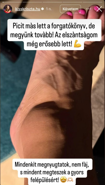 Kiss Kriszta lábfeje csúnyán bedagadt