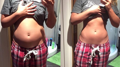 Nem terhes, csak nagy a hasa!