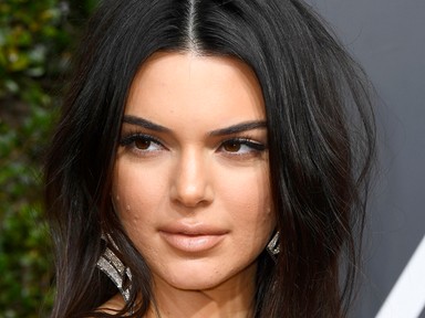 15 sztár, akiknek nagyon problémás a bőre, és mit tesznek ellene