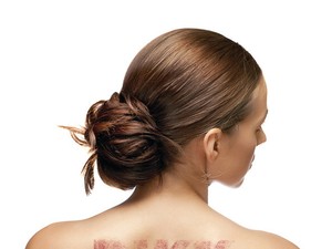 Kim Kardashian és Britney Spears is tünetmentes - Nem késő változtatni!