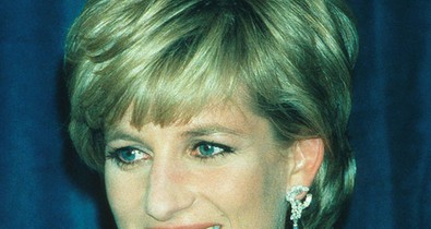 Így néztek volna ki az ikonikus szépségek felpumpált szájjal: ha a mai trendeket követték volna