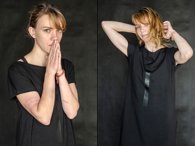 Erős idegzetűeknek! Ez a fotósorozat a nők ellen elkövetett erőszakra hívja fel a figyelmet