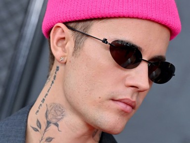 „Valaki segítsen rajta” - Justin Bieber bizarr viselkedésére nehéz szavakat találni