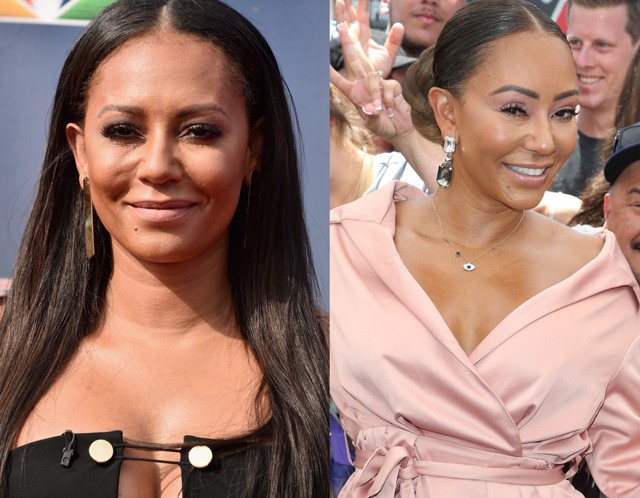 Mel B arca már teljesen felismerhetetlen a sok botoxtól