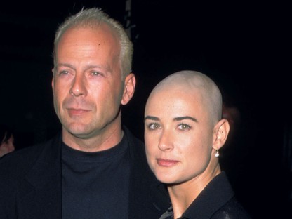 Ijesztő? Szexi? Ezek a nők kopaszra borotválták a fejüket