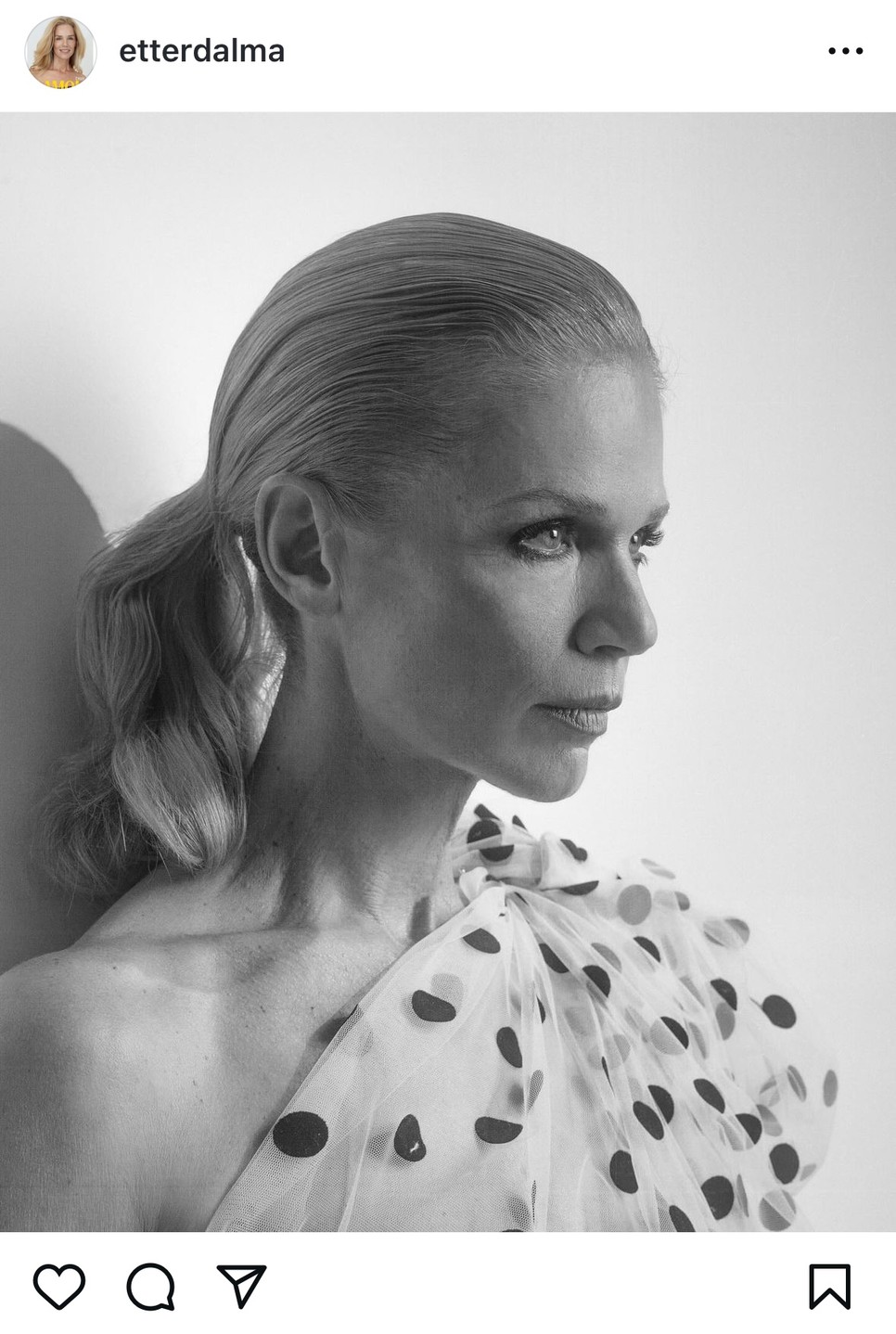 Dalma elmondása szerint rögös út vezetett ez önelfogadásig, mára már azonban jól érzi magát a bőrében