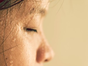 A túlzott izzadás rengeteg embert érint, de könnyen kezelhető!