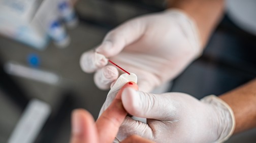 Anonim HIV- és STD-szűrést is kérhetsz ingyenesen a Sziget-fesztiválon