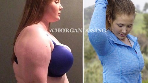 Törölték ennek a lánynak a fotóját - Miért nem tetszik az Instagramnak a fogyás?