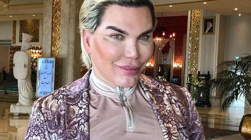 Beteges: ilyen borzalmasan néz ki 69 plasztikai műtét után az élő Ken baba arca