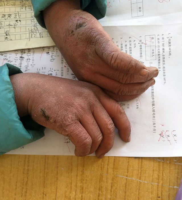 Szívszaggató életkörülmények: 5 kilométert gyalogol a fagyban ez a kisfiú, hogy beérjen az iskolába!