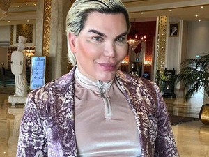 Beteges: ilyen borzalmasan néz ki 69 plasztikai műtét után az élő Ken baba arca