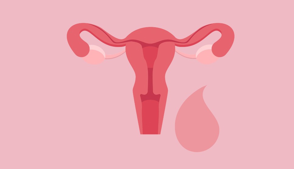  A rövid menstruációk során élénk rózsaszín is lehet a vér színe