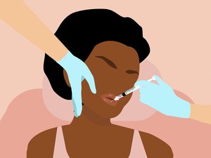 10+1 kérdés, amit tegyél fel a bőrgyógyásznak, mielőtt belevágnál az arc- és szájfeltöltésbe