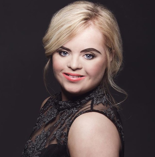 Óriási sikert ért el a gyönyörű Down-szindrómás modell