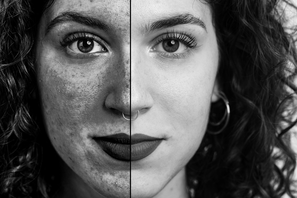 Nem mindegy, milyen fényvédőt választasz