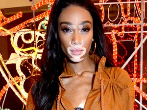 Jaj ne! Winnie Harlow narancsságra börtönruhát viselt a vörös szőnyegen!